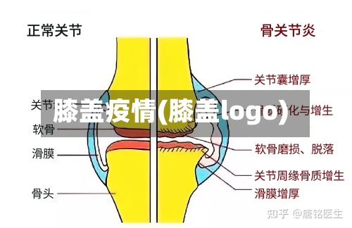 膝盖疫情(膝盖logo)
