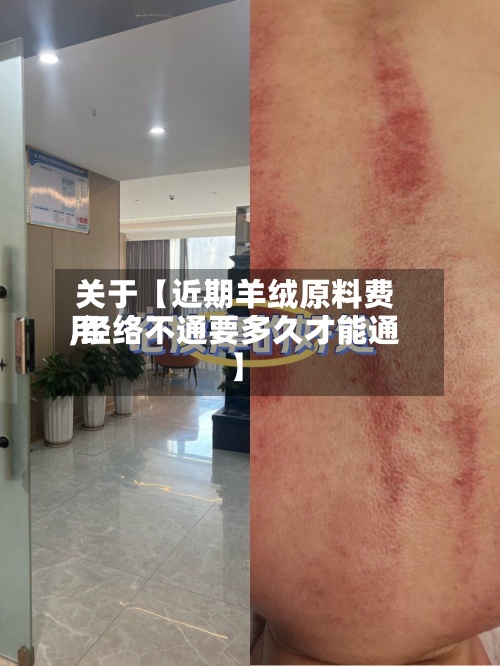 关于【近期羊绒原料费用,经络不通要多久才能通】-第2张图片