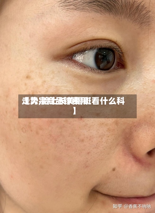 【大宗商品锌费用
走势,脸上长黄褐斑看什么科】-第2张图片